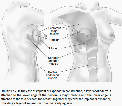 Breast Reconstruction Washington DC