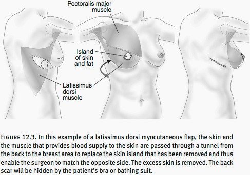 Breast Reconstruction Washington DC