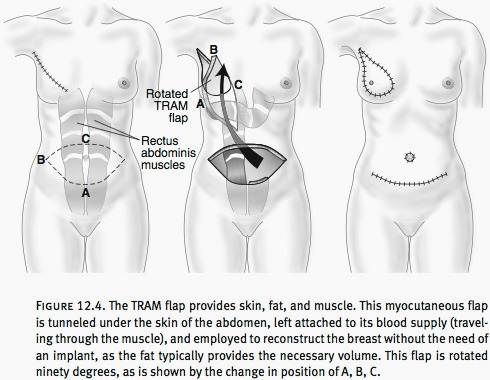 Breast Reconstruction Washington DC