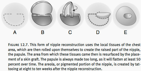Breast Reconstruction Washington DC