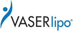 Vaser Liposuction Washington DC